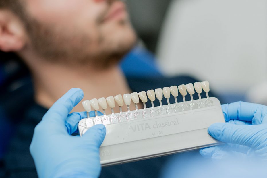 Blanqueamiento dental en Valencia