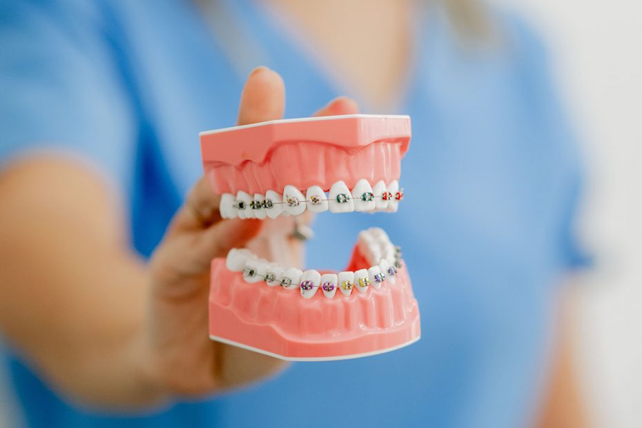 Ortodoncia en valencia